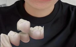 做了牙冠可以做正畸吗