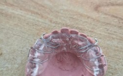 正畸口内阻挡臂