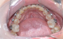 广州牙齿矫正选康圆靠谱吗？效果和口碑如何？