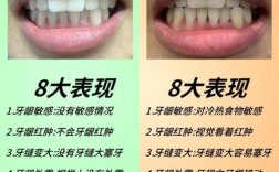 牙龈萎缩种牙吗