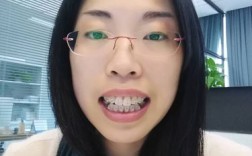 常州口腔医院矫正牙齿效果好不好？价格透明吗？值得选吗？