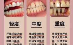 牙龈萎缩还能种牙吗？种牙需注意哪些问题？