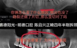 矫正后老了牙齿会松吗？