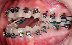 北京牙齿矫正哪家医院靠谱？