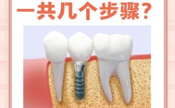 种牙是因为什么