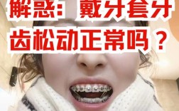 正畸牙时 感觉牙齿松动