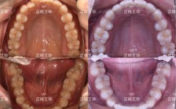 成都华美正畸怎么样？正畸查找攻略有哪些？