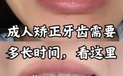 18岁矫正牙齿还来得及吗？成年后还有机会让牙齿变整齐吗？