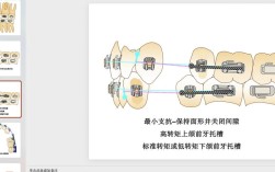 正畸软组织H线分析法在矫治中有何关键应用意义？
