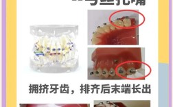 正畸弓丝末端回弯步骤的具体操作步骤和注意事项有哪些？