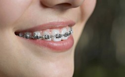 牙齿矫正全过程视频，矫正到底要经历哪些关键步骤？