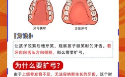 正畸扩弓的适应症