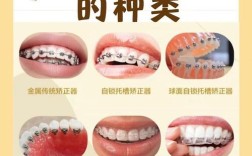 正畸托槽怎么辨别？实用方法技巧全在这！