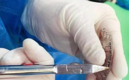 牙齿矫正手术视频能展示全过程吗？效果和实际一致吗？