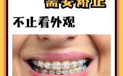 什么人适合矫正牙齿？这些情况该做吗？