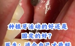 种一颗牙为何动辄上万？价格背后的技术成本与患者负担引热议，到底值不值？