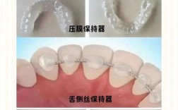 正畸中保持阶段的具体含义是什么？