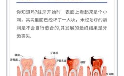 补牙的方法有几种类型