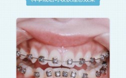 25岁矫正牙齿还来得及吗？