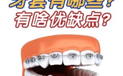 牙齿矫正必须先矫上面吗？