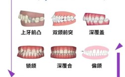 牙齿哪些样子出现就需要矫正？
