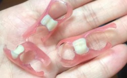 隐形牙有多少种