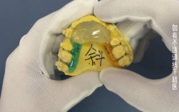 戴牙齿矫正导板说话会受影响吗？