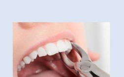 矫正牙齿费用高，没钱该怎么办？