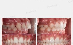 南京 矫正牙齿哪里好