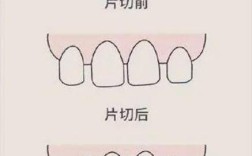 正畸邻面接触关系