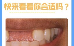 50多岁种牙合适吗？高龄种牙有哪些注意事项？