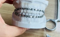 牙齿矫正托槽松动