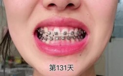 大连矫正牙齿好的，哪家医院正畸靠谱？