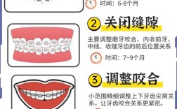 正畸骨性二类是什么