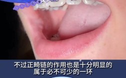 牙齿矫正橡皮圈戴了之后好痛，是什么原因导致的？