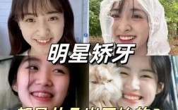 明星矫正牙齿都在哪家医院做的？揭秘变美机构！