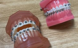 南京哪里牙齿矫正好