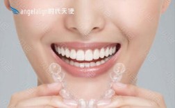 拜博口腔的时代天使矫正服务如何？效果和口碑真的值得信赖吗？