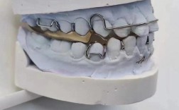 地包天牙用什么方法矫正比较好？