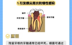 种植牙会有哪些风险？这些隐患如何规避？