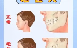 儿童地包天矫正方法有哪些？如何选对适合的治疗方式？