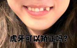 不拔虎牙矫正牙齿，效果与美观能兼顾吗？