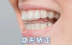 隐形矫正牙齿整形真的安全有效吗？效果能维持多久？