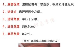 种牙手术为何采用局部麻醉？其具体类型和适用情况是怎样的？