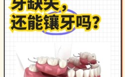 最多能种几颗牙