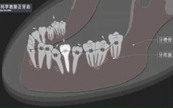 正畸牙齿移动动态图
