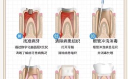 口腔牙根管治疗方法