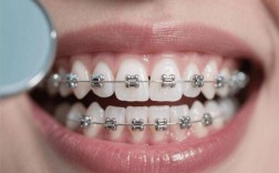 口腔诊所能矫正牙齿吗？哪些情况适合？