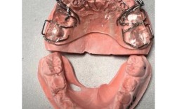 正轴簧在牙齿矫正中的作用原理和效果如何？