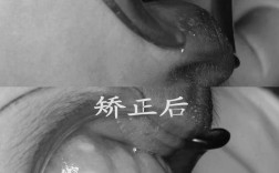 南京明星牙齿矫正为何成热门选择？效果和医生技术如何？